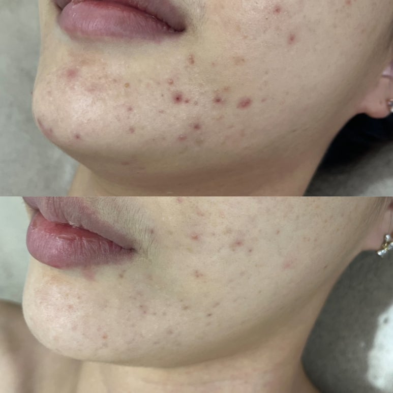 루시아 피부관리 이미지