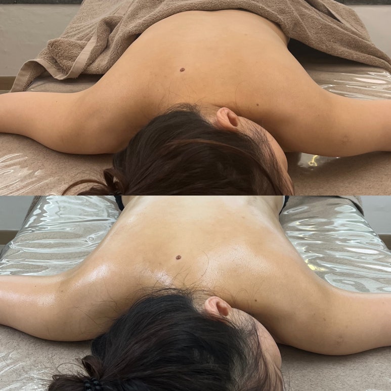 루시아 피부관리 이미지