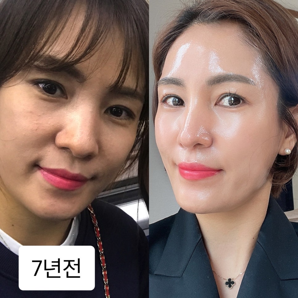 인셀덤 오케이 이미지