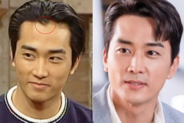 이미지헤어라인 이미지