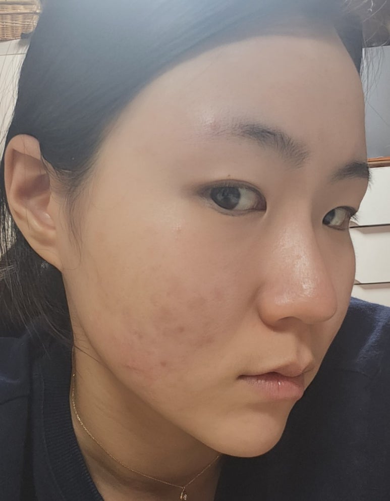 심플홈케어 이미지