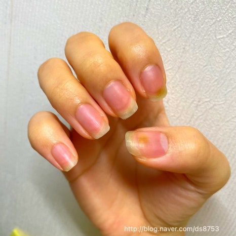 달빛손톱 이미지