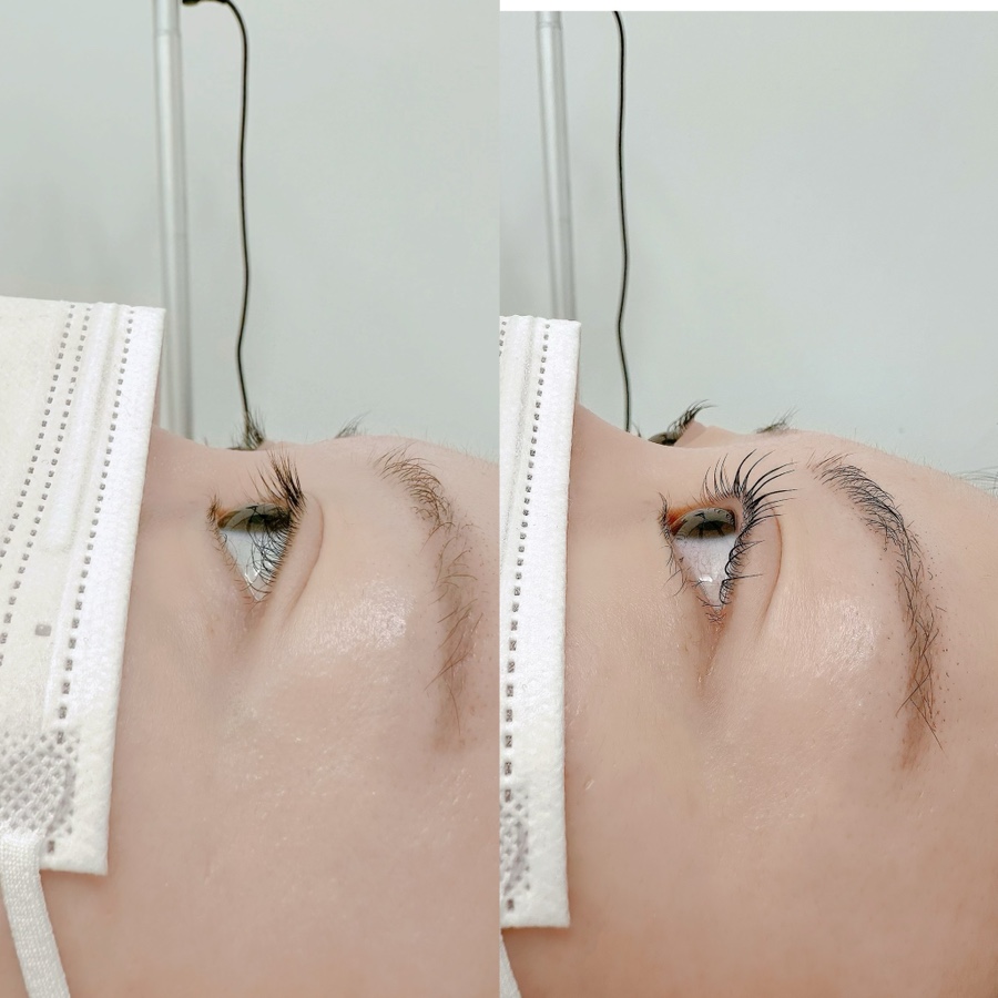 아이포유 이미지