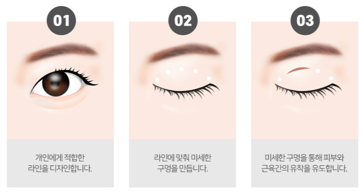 꼼꼼성형외과의원 이미지