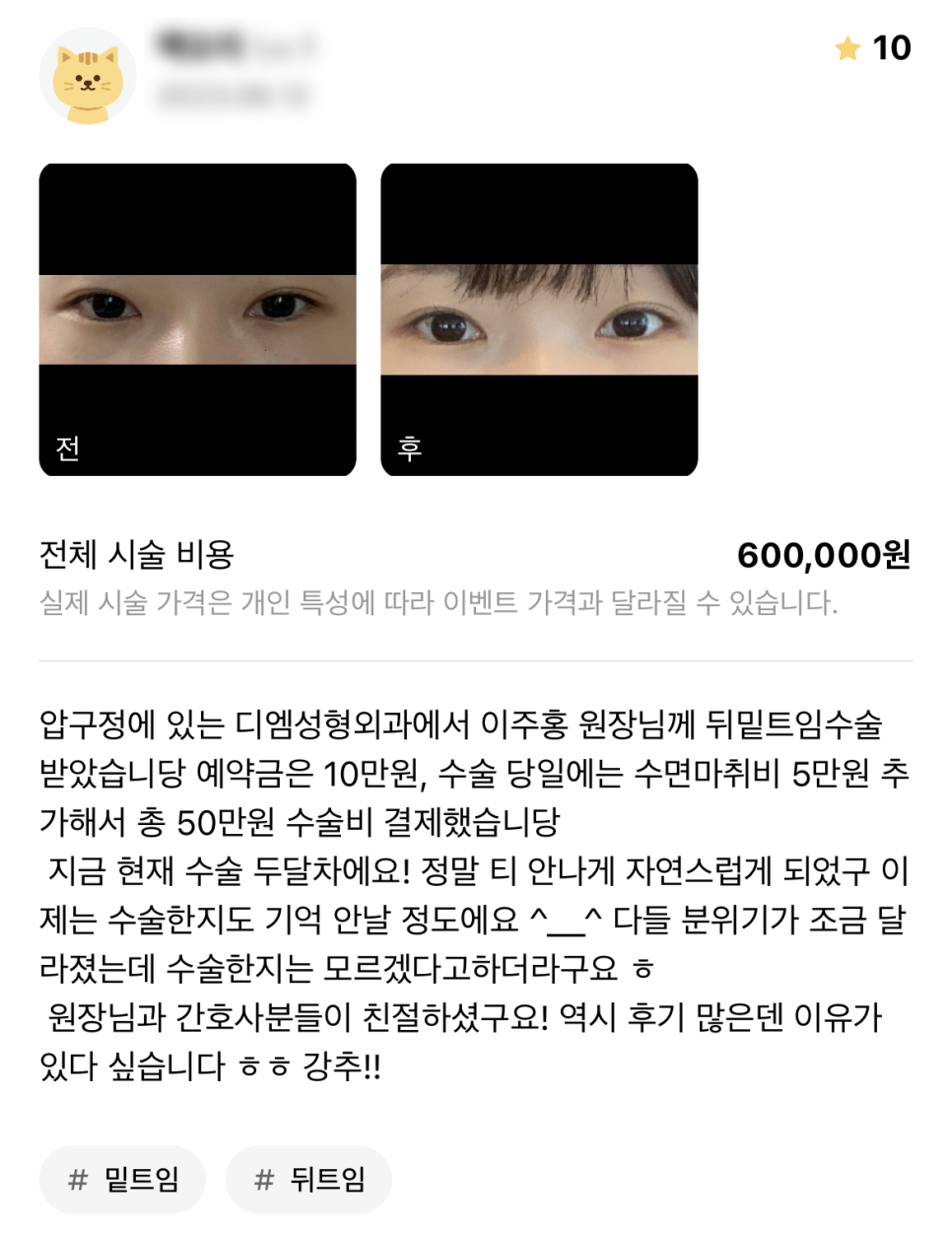 비디엠티 이미지