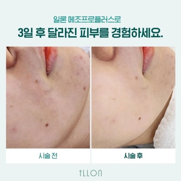 홈케어플러스 이미지