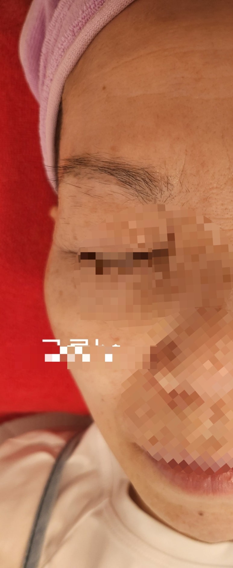 미소붐에스테틱 이미지