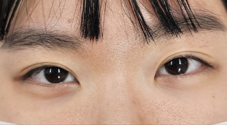 린 아이래쉬 이미지