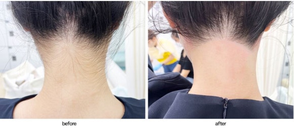 피부를바꾸다 이미지