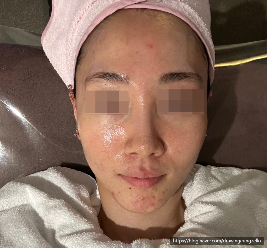 수앤수스킨케어 이미지