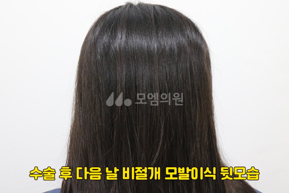 필헤어라인 이미지