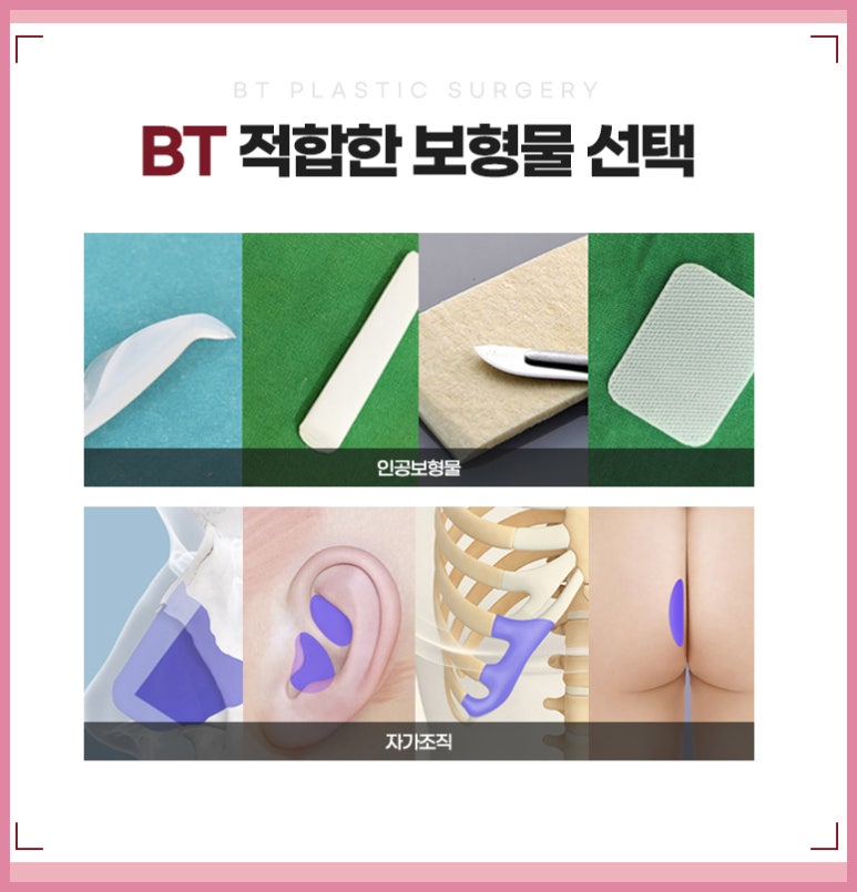 비티라인 이미지