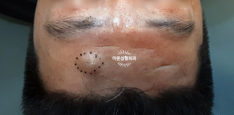 아문성형외과의원 이미지