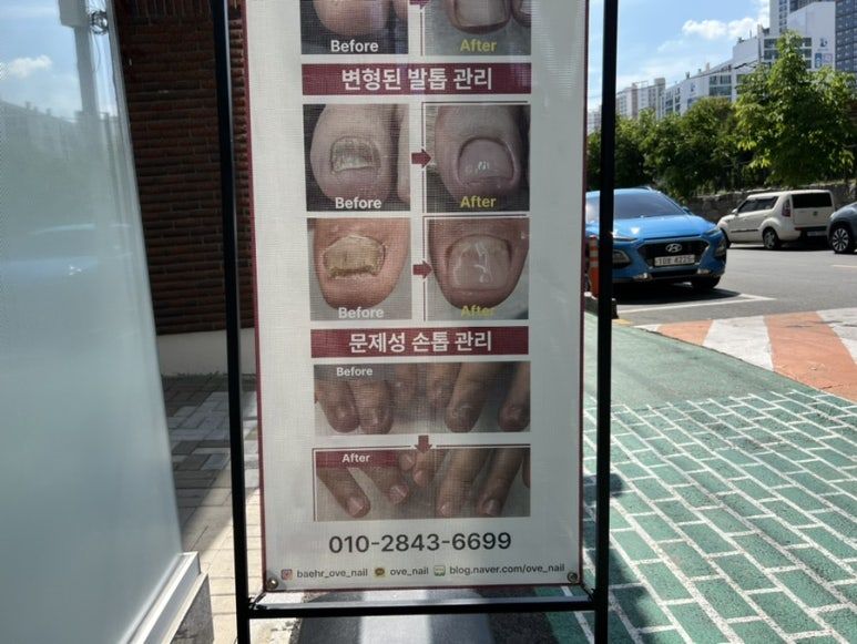 오브네일 이미지