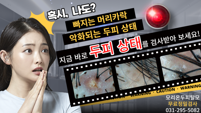 모리온두피탈모 이미지
