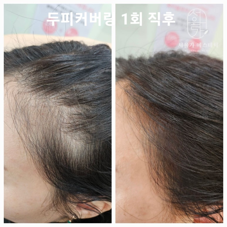 서율가에스테틱 이미지