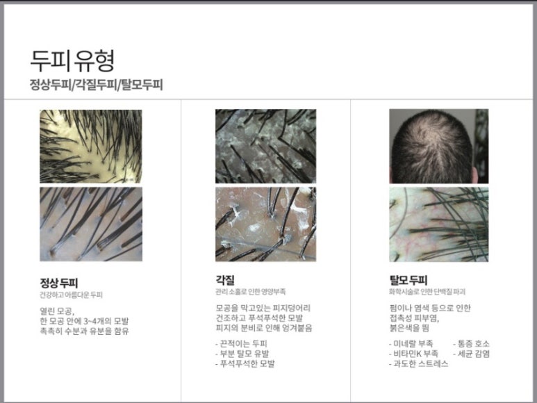 에코레비헤어헤드스파광주 이미지