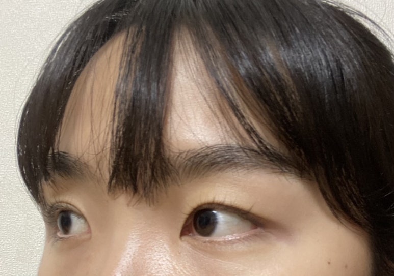 루즈에스테틱 이미지