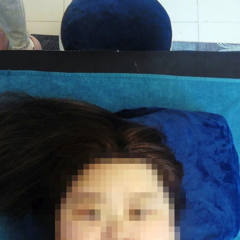 윤두피SPA 이미지