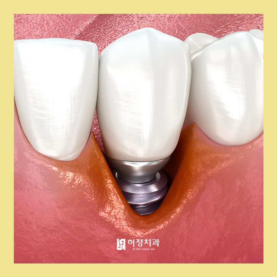 허정치과의원 이미지