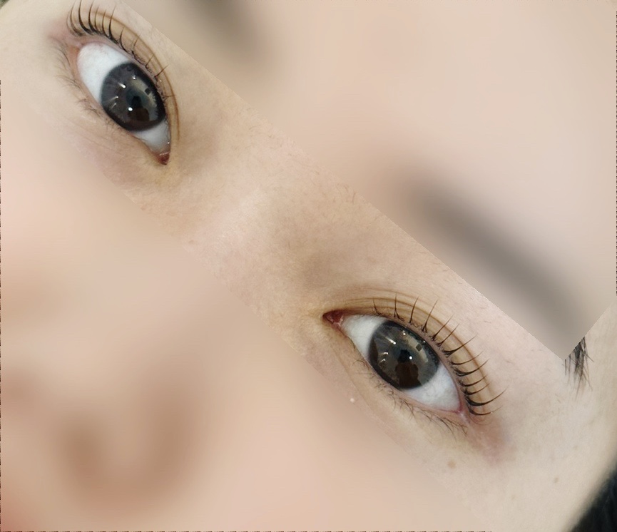 레빗브로우 이미지