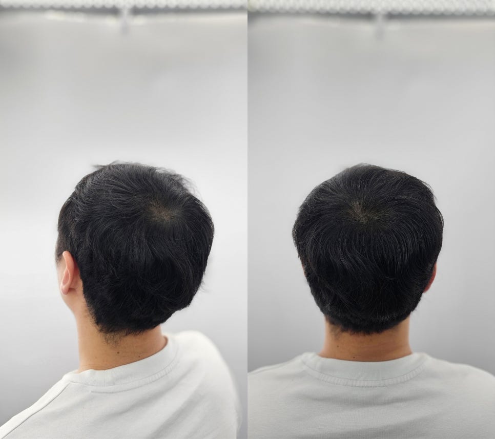 헤드샷스칼프SMP부산 이미지