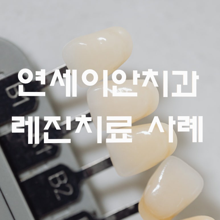 연세이안치과 이미지
