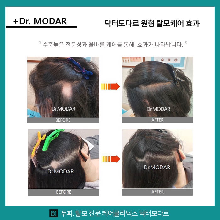 두피에진심 이미지