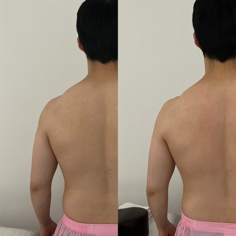 선바디테라피 이미지