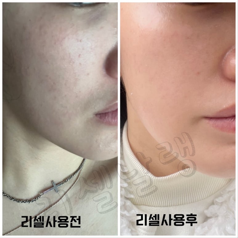리셀라인 이미지
