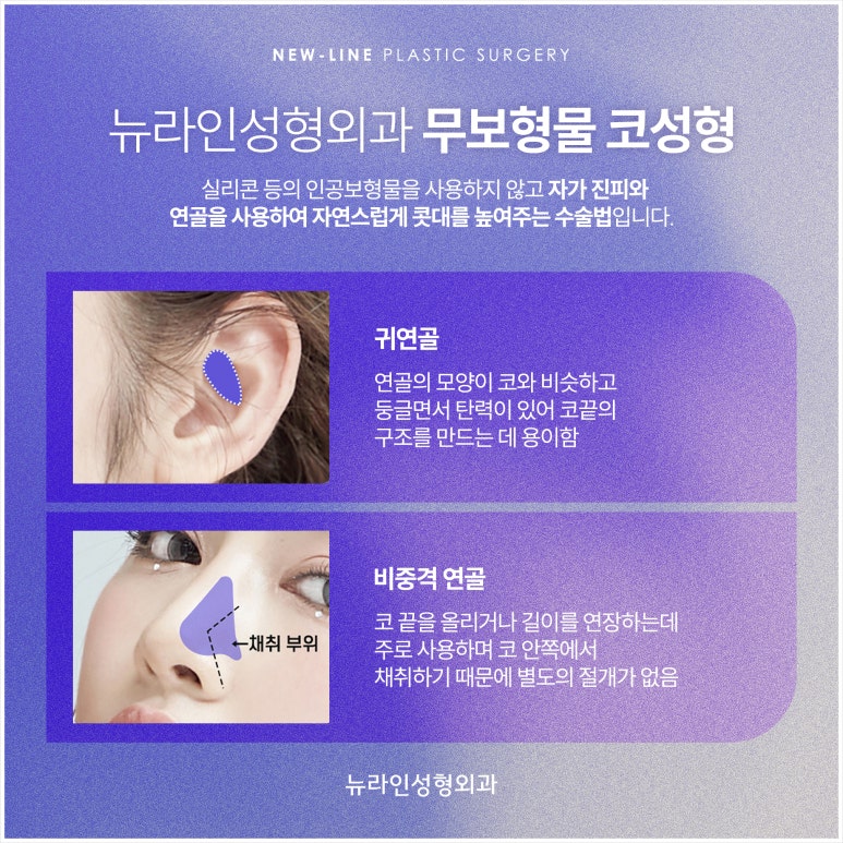 준성형외과 이미지