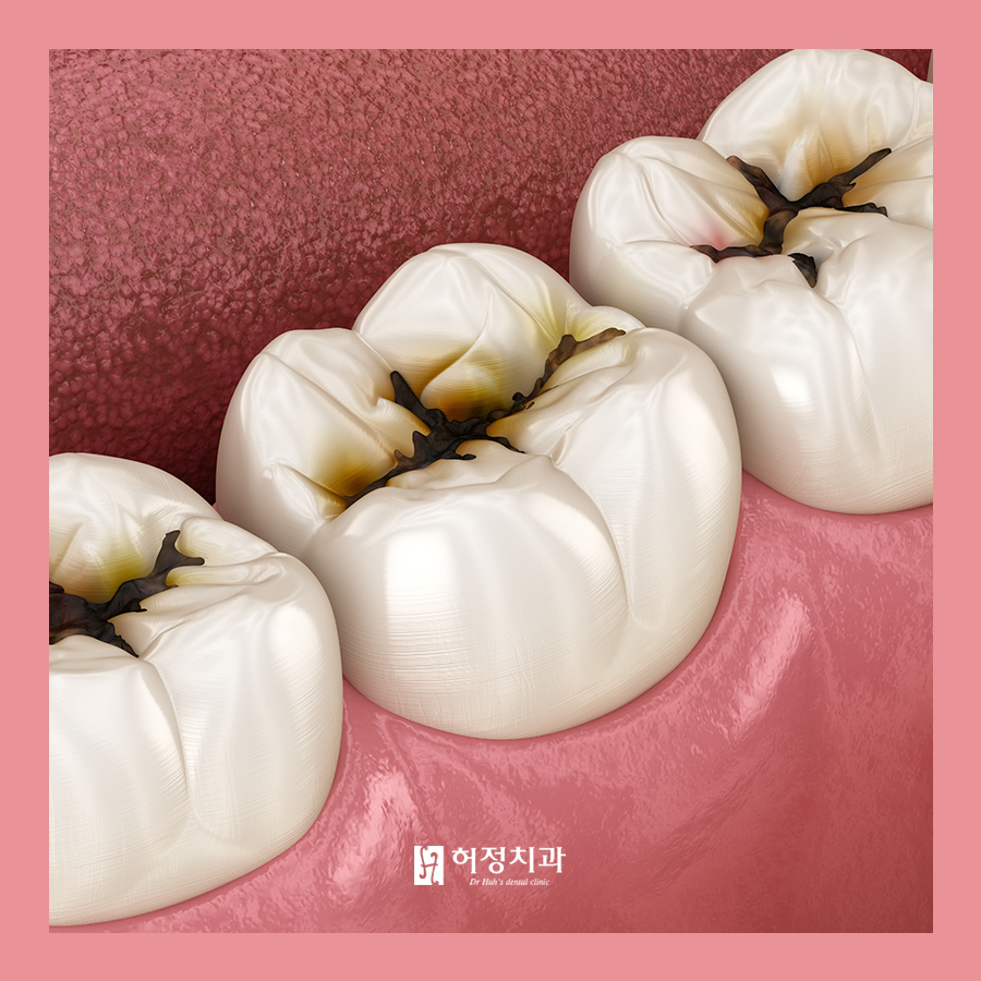 허정치과의원 이미지