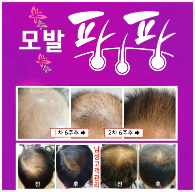 큐사랑 이미지