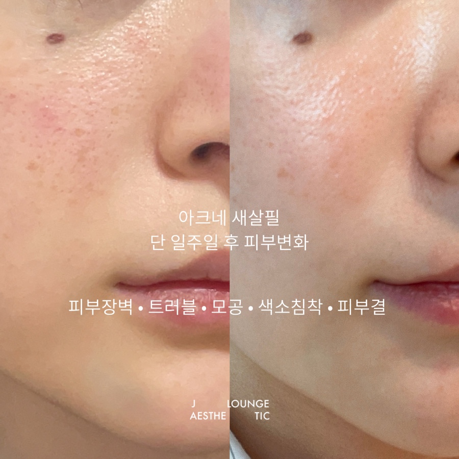 제이에스테틱 이미지