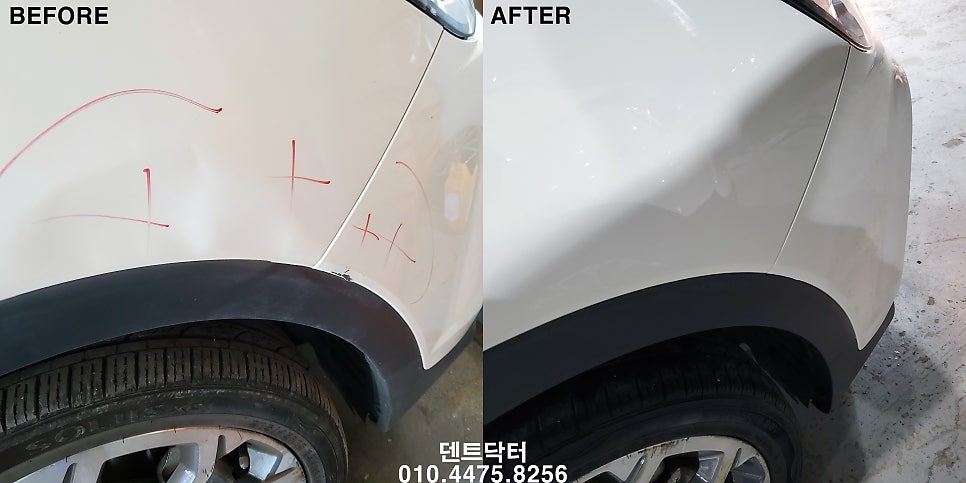 덴트닥터 이미지