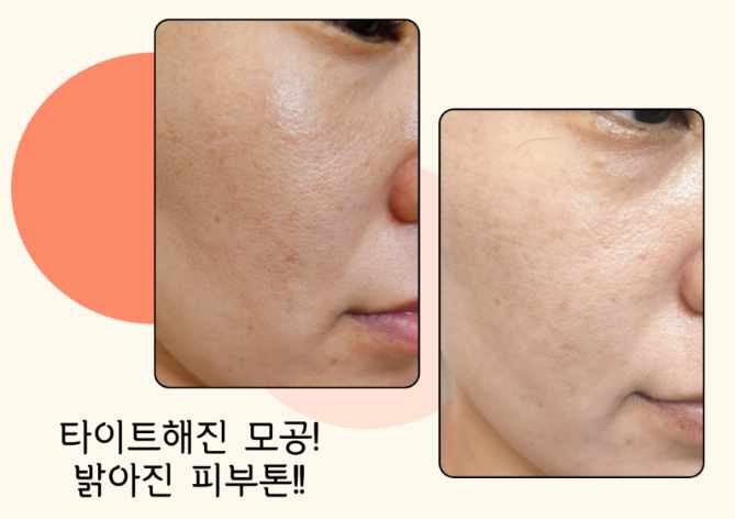 숲칼프 동대구역점 이미지