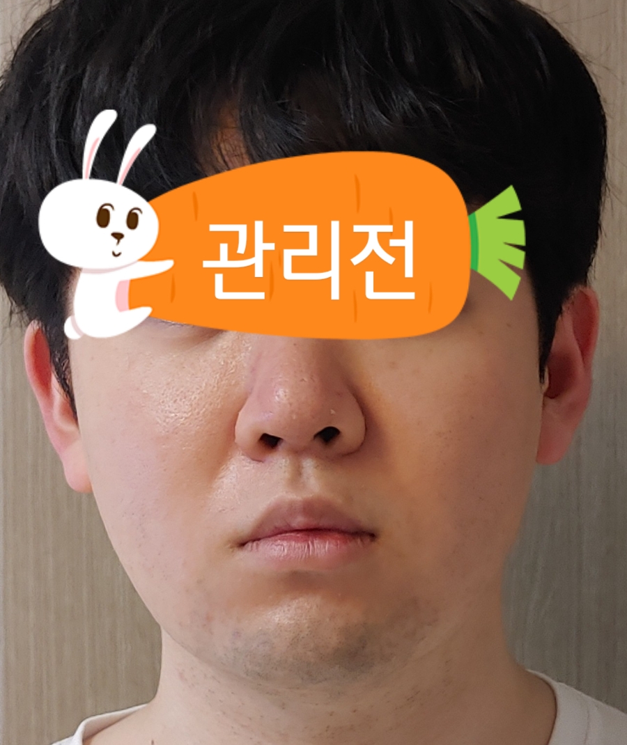 사.코 이미지