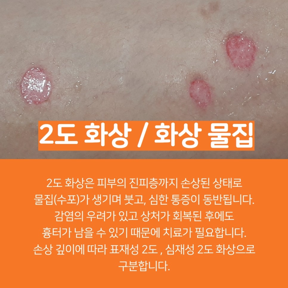 오늘봄성형외과의원 이미지