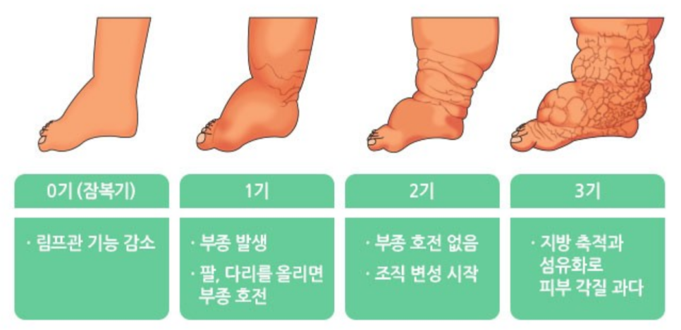 대한림프부종학회 이미지