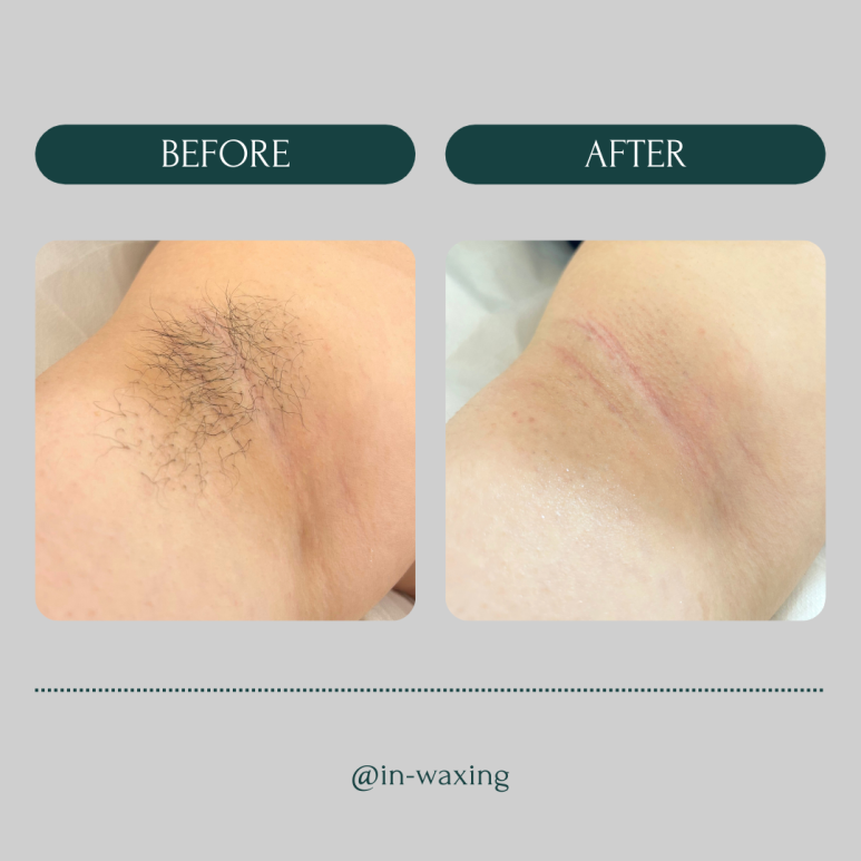 in_waxing 이미지
