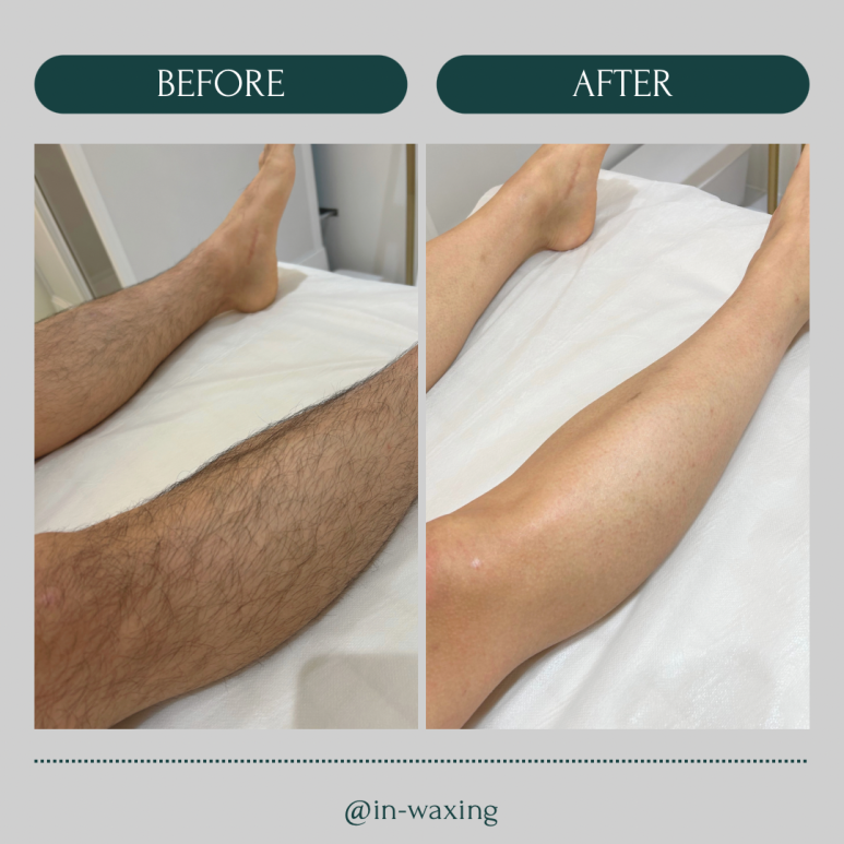 in_waxing 이미지