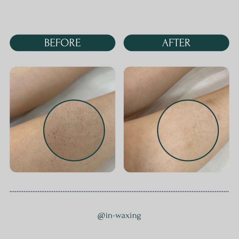 in_waxing 이미지