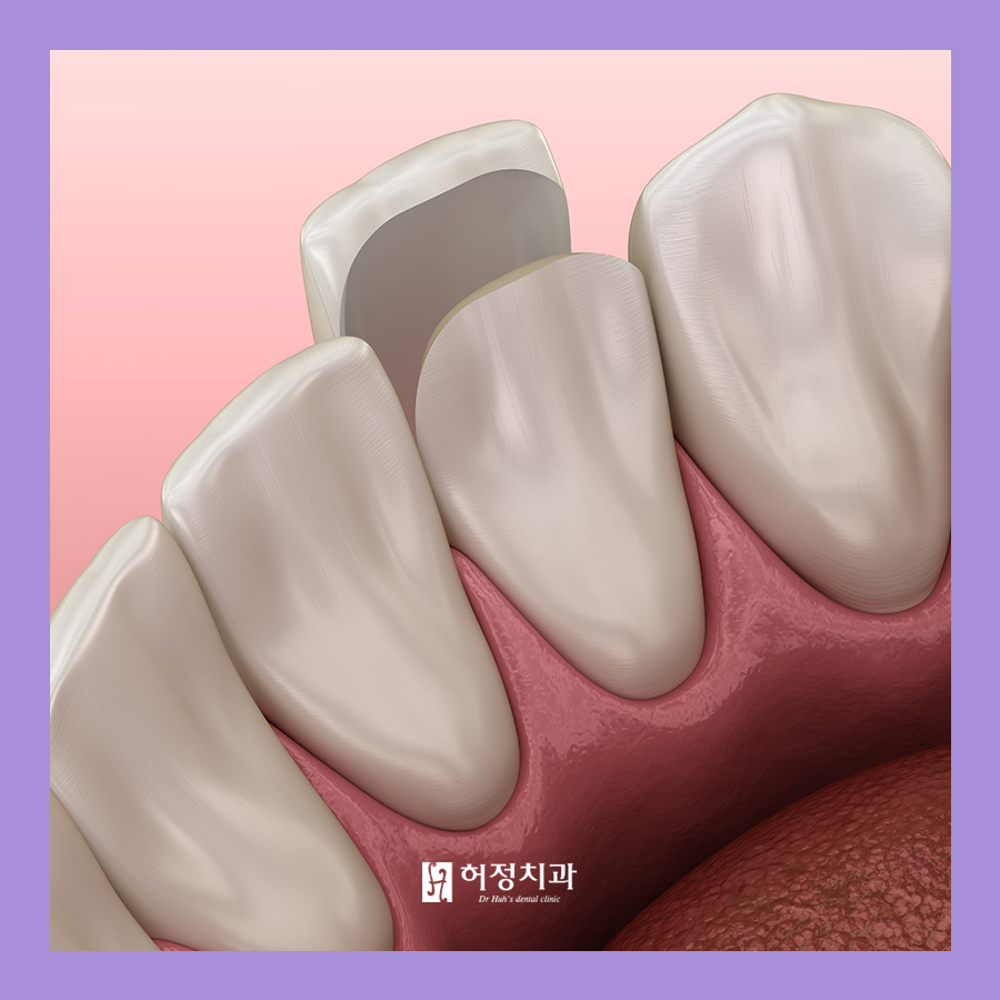 허정치과의원 이미지