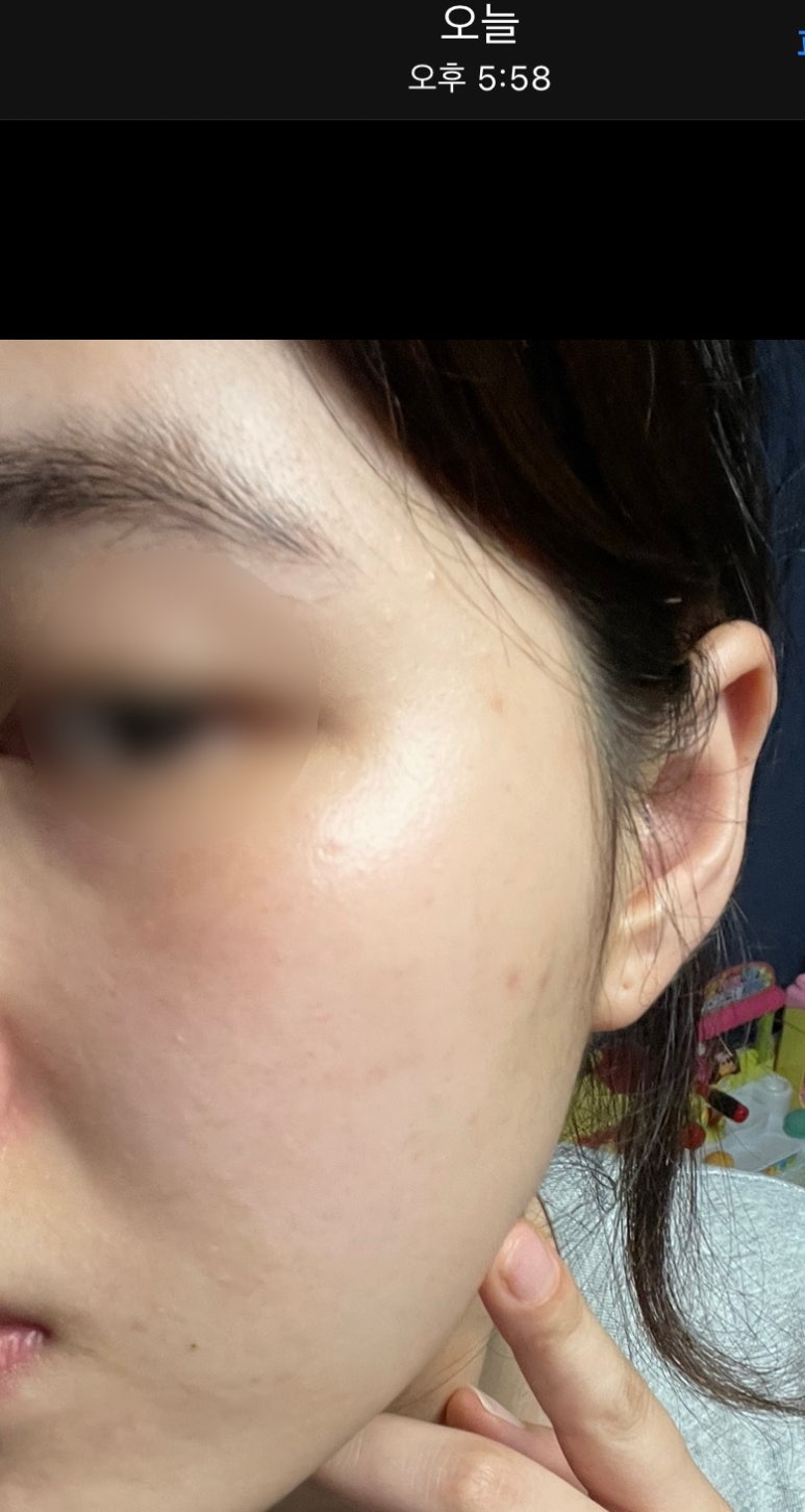 라벨라스킨케어 이미지