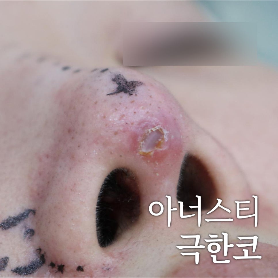아너스티성형외과의원 이미지