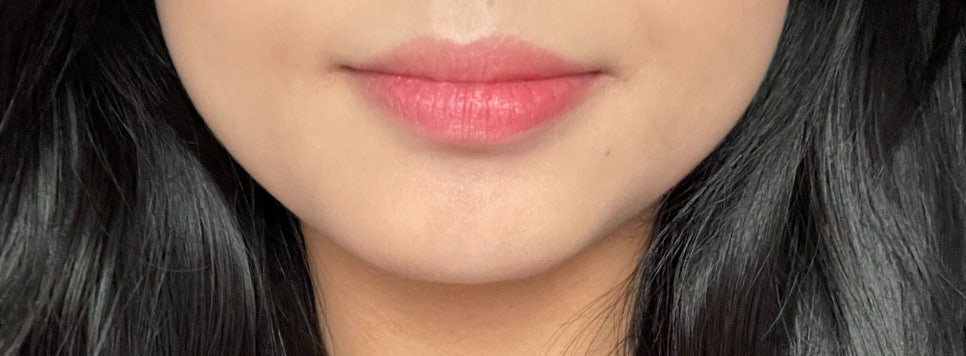 보스톤탑치과의원 이미지