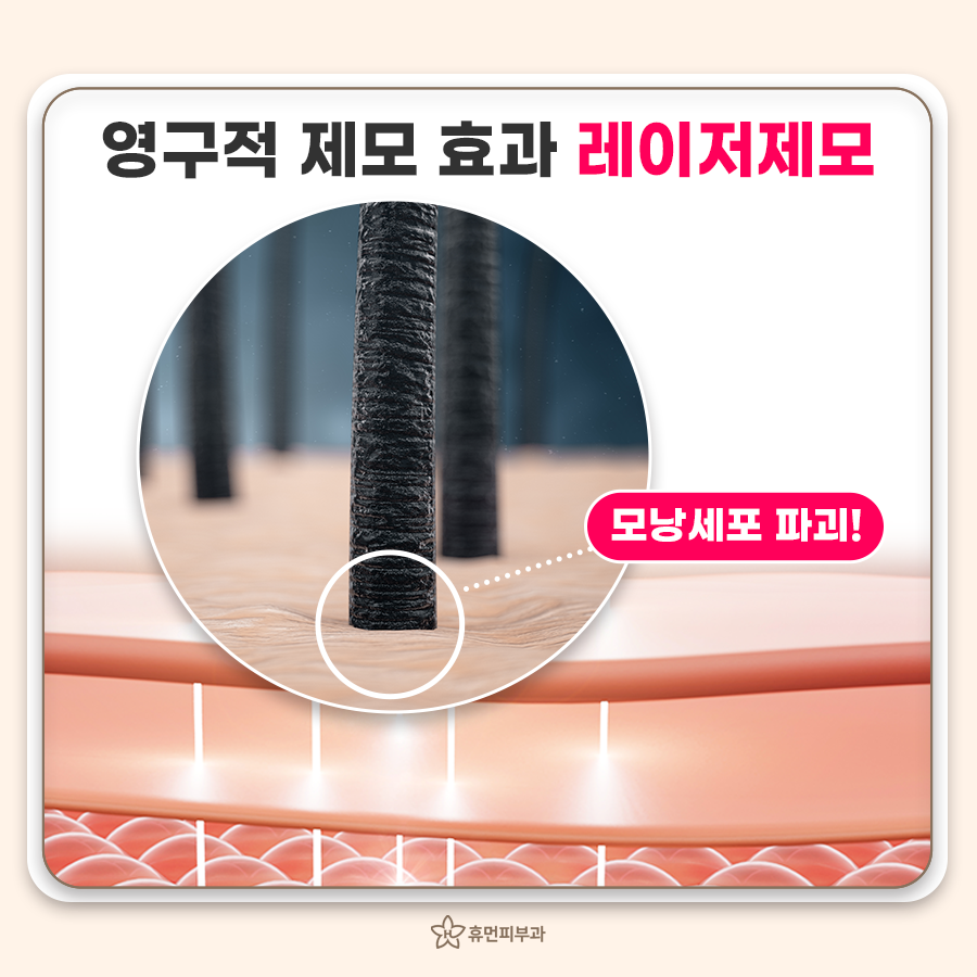 천안수피부과 이미지