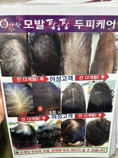 큐사랑일산 이미지