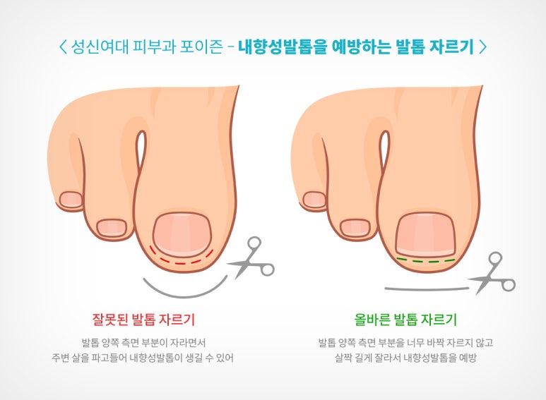공피부과 이미지