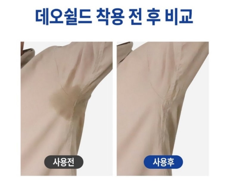 에스크리션 이미지